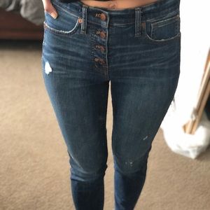 Madewell 10” High Rise Skinny Jeans